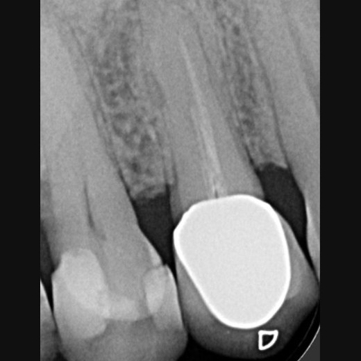 11908: 14 mit 3 Kanälen