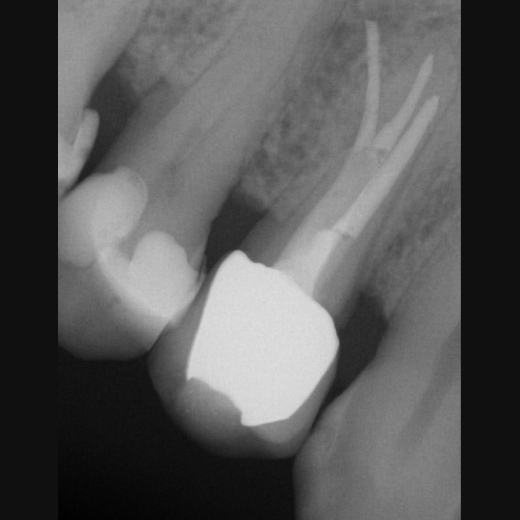 11908: 14 mit 3 Kanälen