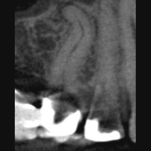 12102: 15 mit starker Krümmung