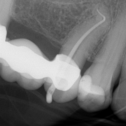 12102: 15 mit starker Krümmung