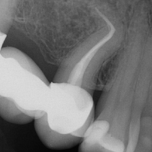 12102: 15 mit starker Krümmung