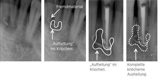 endodontie 2