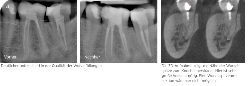 endodontie 4