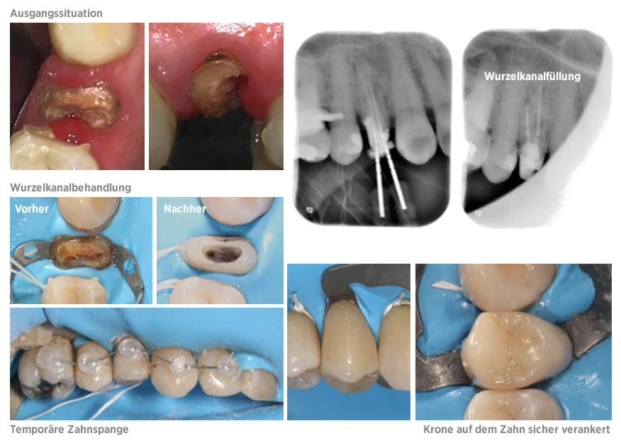 ble fb case of the week