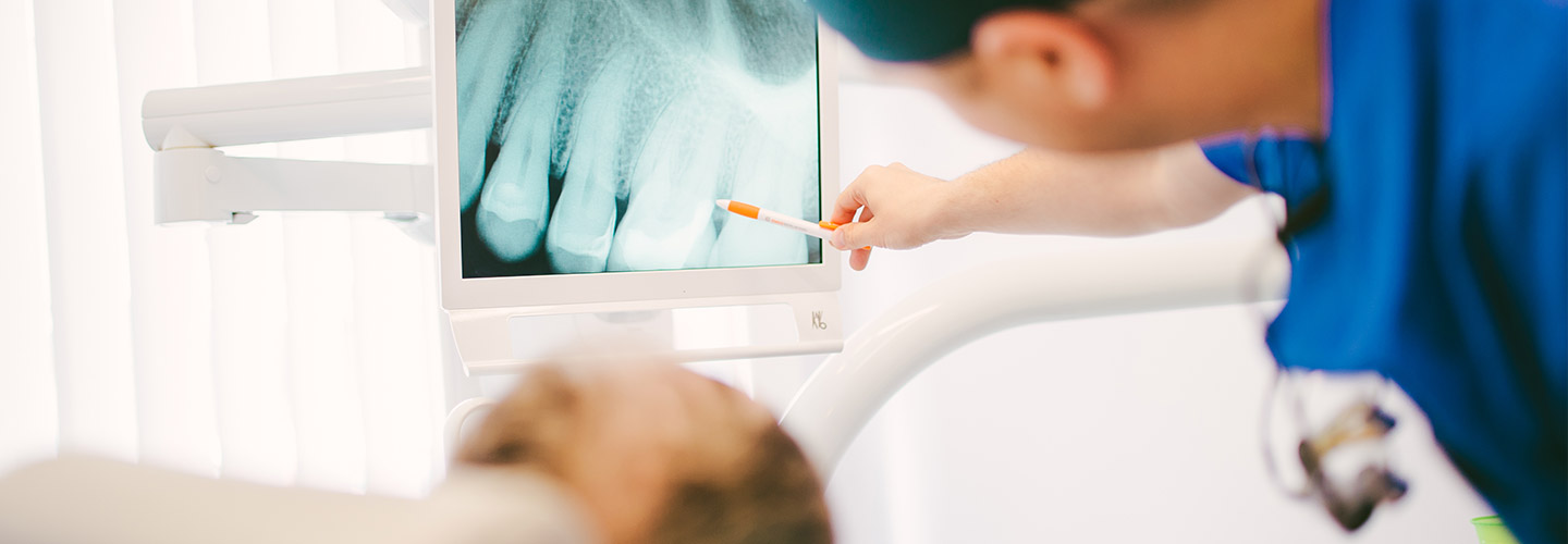 head revision wurzelkanalbehandlung