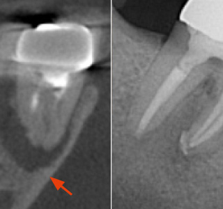 teaser kl fallbeispiele